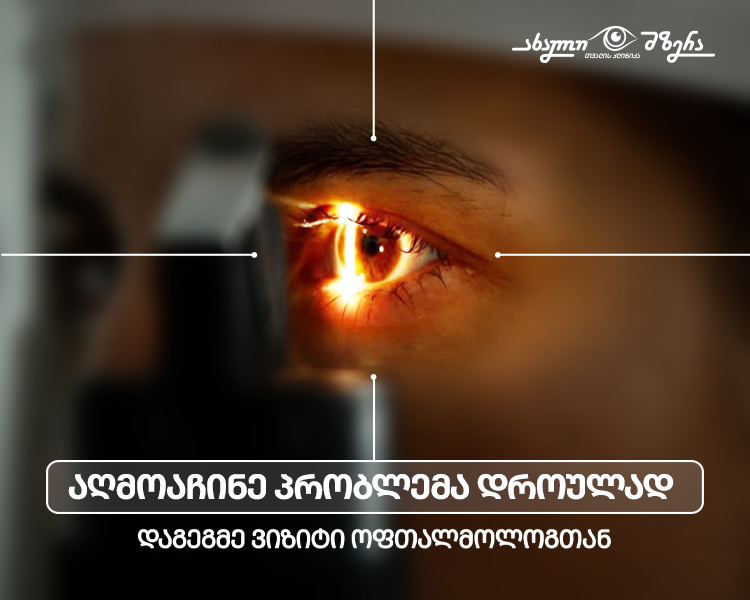 როგორ ისარგებლოთ იმედი ელ-ის Imedi L-ის დაზღვევით თვალის კლინიკა „ახალი მზერა“-ში